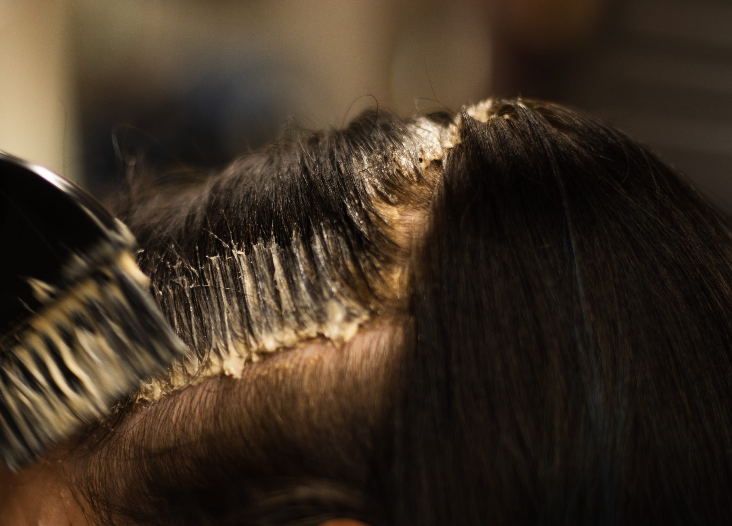 Root Retouch
